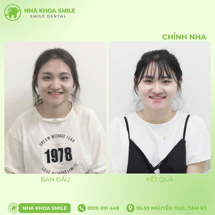 Hình ảnh Nha Khoa Smile Tam Kỳ 2