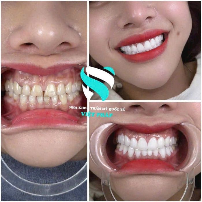 Hình ảnh Nha Khoa Việt Pháp Dental - Nha Trang 2