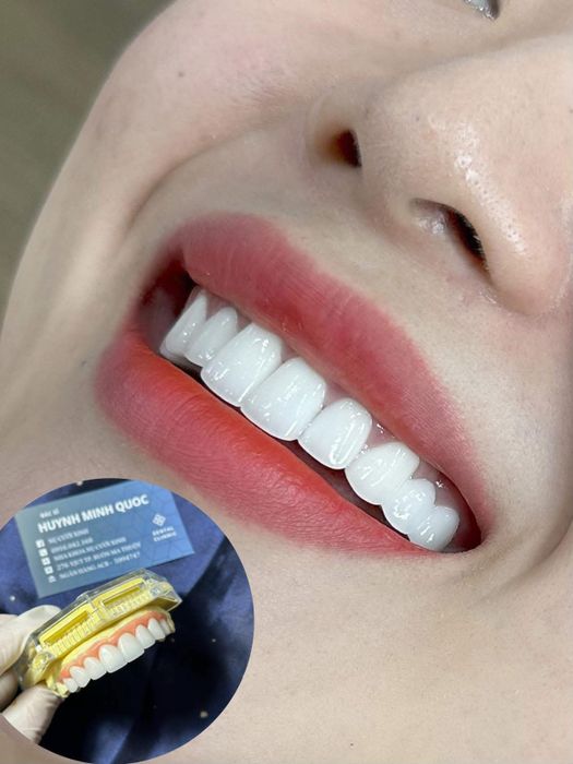 Nha Khoa Nụ Cười Xinh hình ảnh 2
