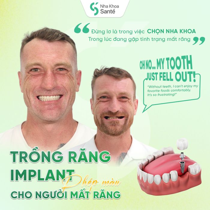 Hình ảnh Nha Khoa Santé 1