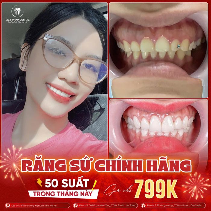 Hình ảnh Nha Khoa Quốc Tế Việt Pháp 2