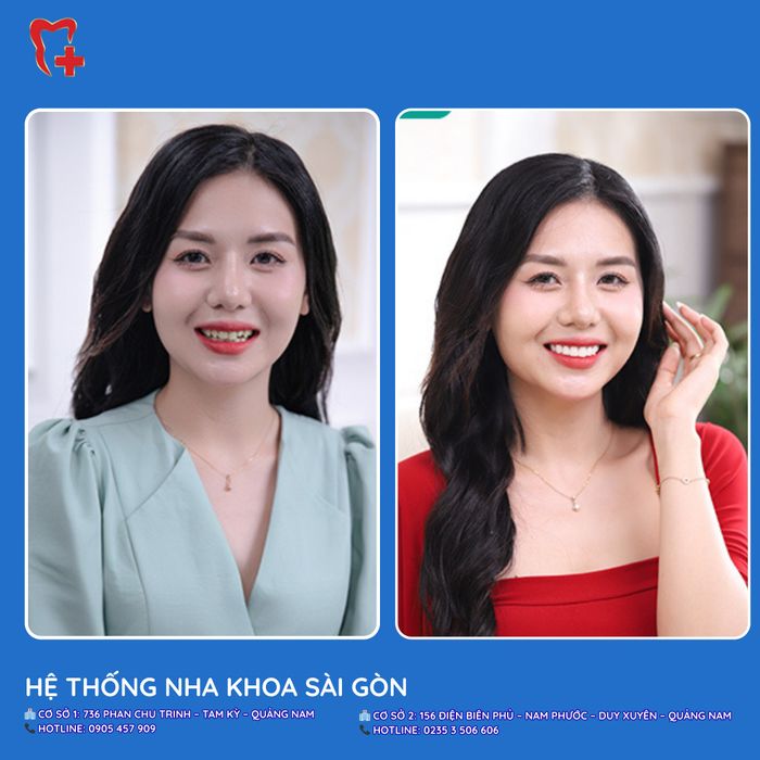 Hình ảnh Nha Khoa Sài Gòn 1