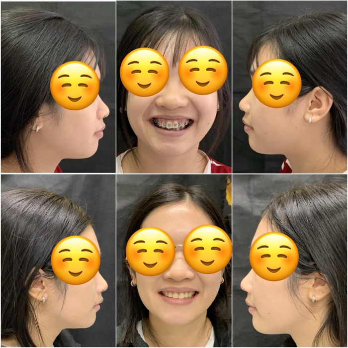 Nha Khoa Thuấn Thư Hình 1