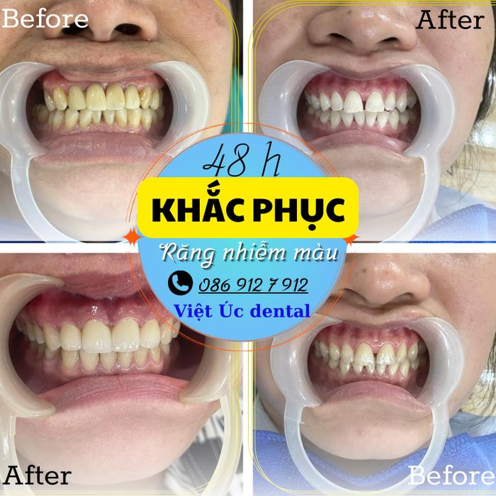 Nha Khoa Thẩm Mỹ VIỆT ÚC - Hình ảnh 2