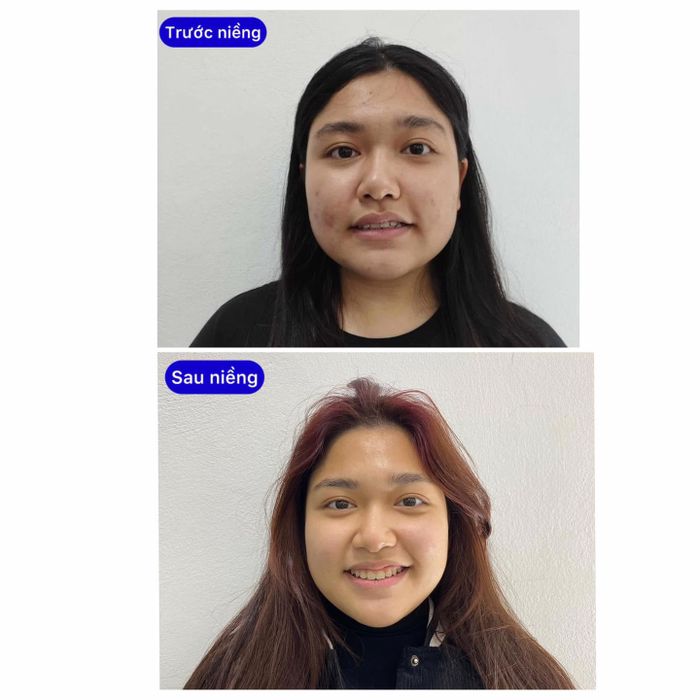 Hình ảnh 1 của Nha khoa Tùng Anh