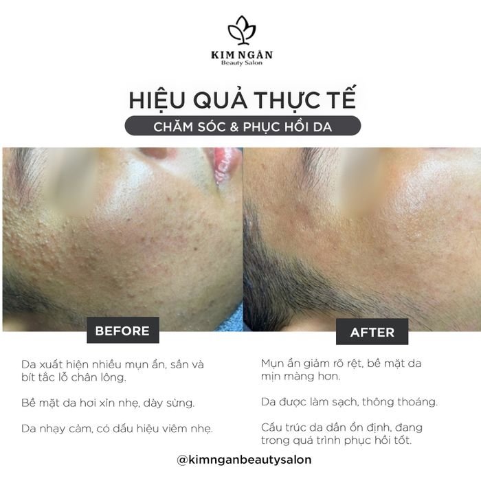 Hình ảnh Kim Ngân Beauty Salon 2