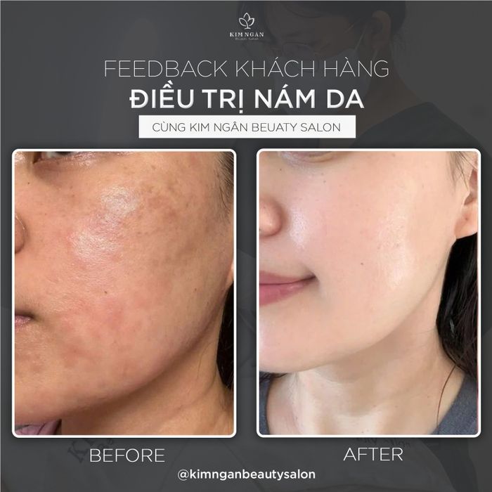 Hình ảnh Kim Ngân Beauty Salon 1