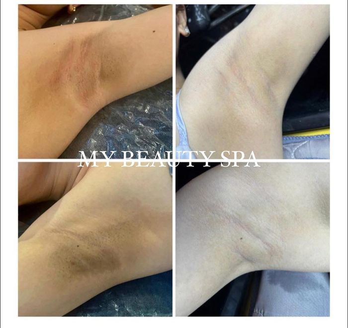 Hình ảnh My Spa 1
