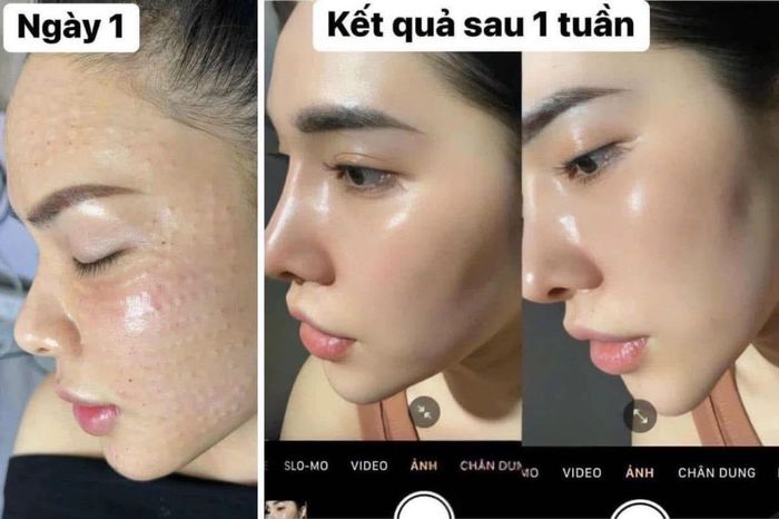 Hình ảnh My Spa 2