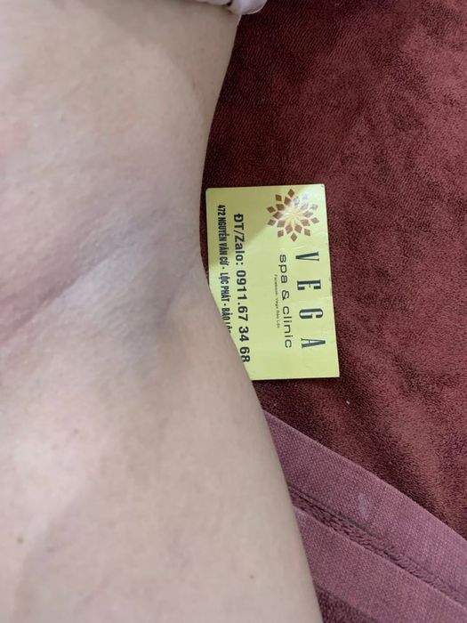 Vega Spa ảnh 1