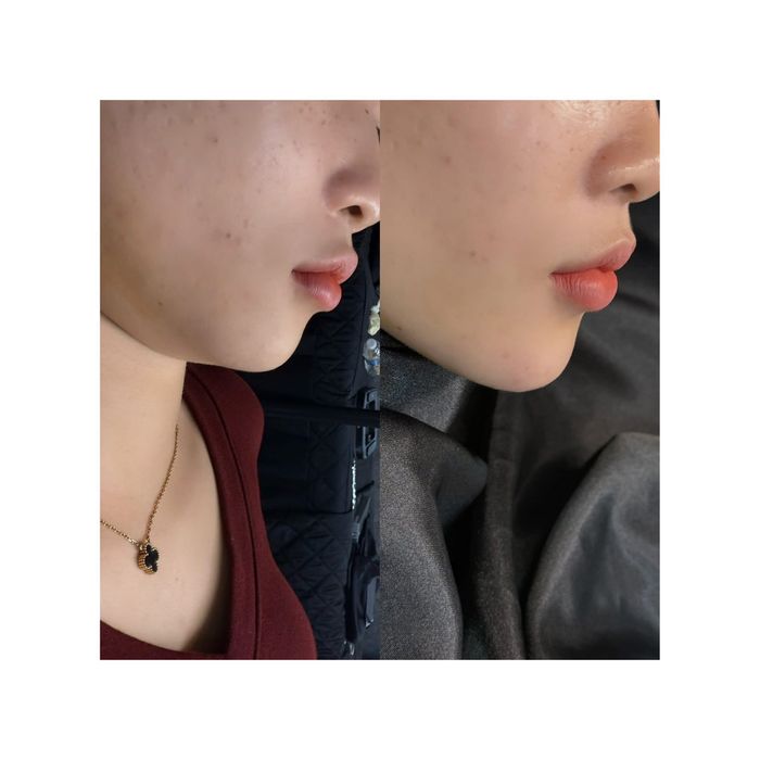 Hình ảnh Kiều Trâm Spa & Skincare 2