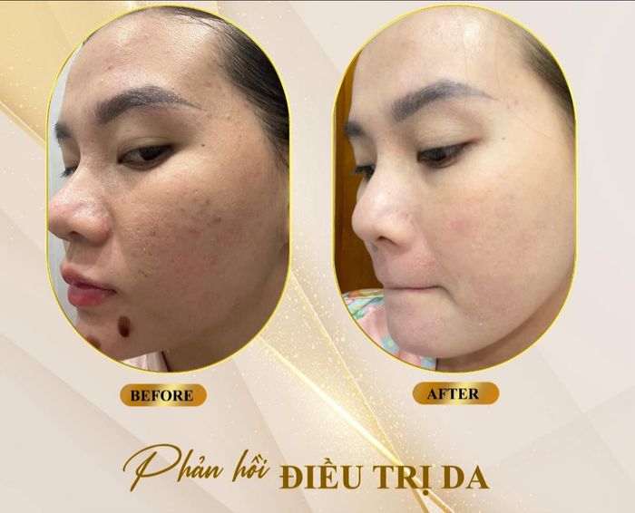 Hình ảnh Kiều Trâm Spa & Skincare 1