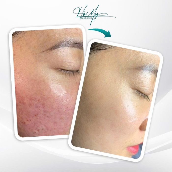 Hà My Spa ảnh 2