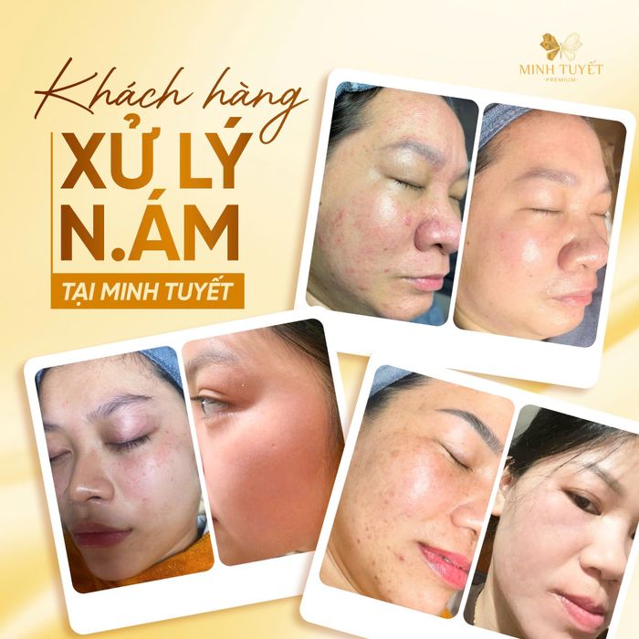 Thẩm Mỹ Viện Minh Tuyết – hình ảnh không gian 1