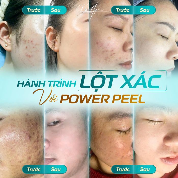 Hà My Spa ảnh 1