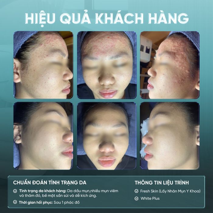 Hình ảnh Gà Spa Bến Tre 1
