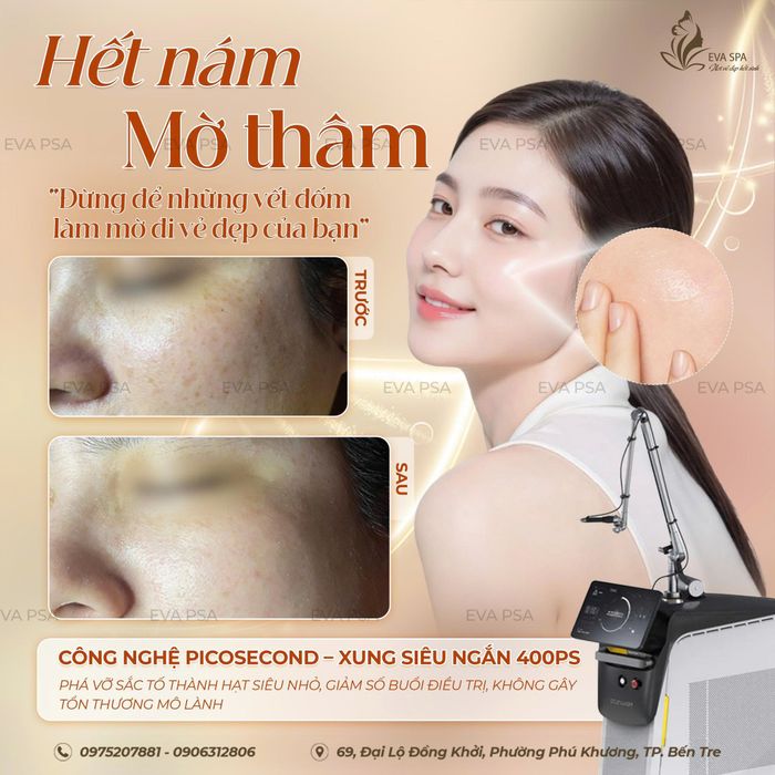 Hình ảnh Mỹ Tiên Spa Bến Tre 1