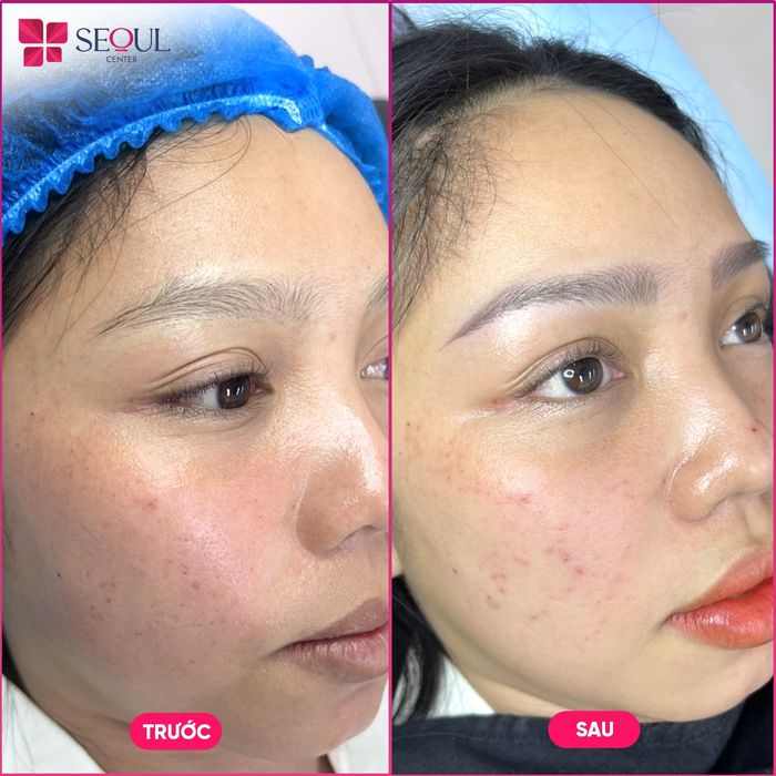 Hình ảnh Thẩm Mỹ Seoul Center Bến Tre 2