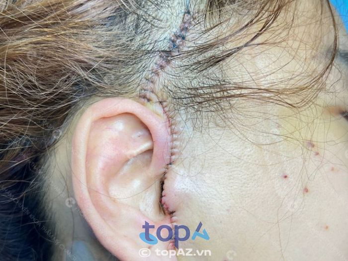 Phòng khám chuyên khoa Thẩm mỹ CHANGI – P. Tân Định