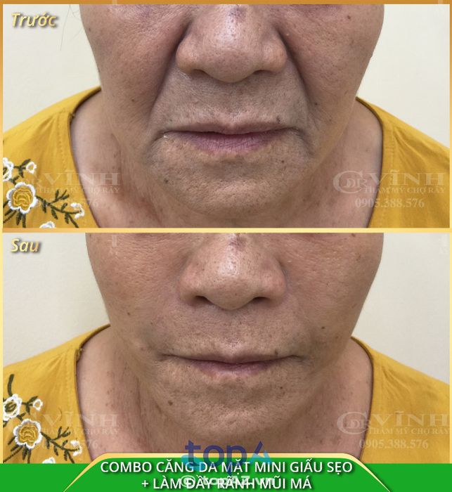 Thẩm mỹ viện DR VĨNH – Xã Bình Hưng