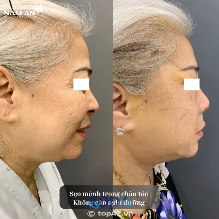 Bệnh viện thẩm mỹ Nam An – P. Vườn Lài