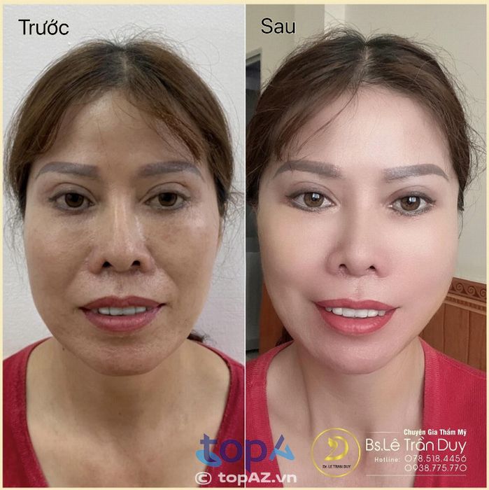 Thẩm mỹ viện Galaxy – BS Lê Trần Duy – P. Bình Tây