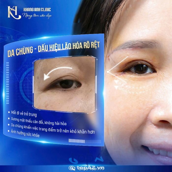 Phòng khám Da liễu Thẩm mỹ Khang Anh – P. Thới An
