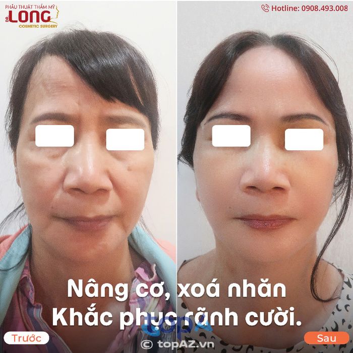 Phẫu thuật thẩm mỹ BS Long – P. Vườn Lài
