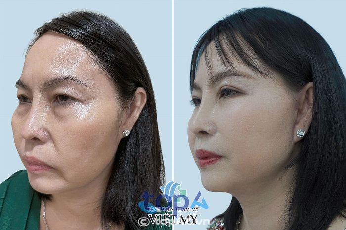 Bệnh viện Thẩm mỹ Việt Mỹ – P. Cầu Ông Lãnh