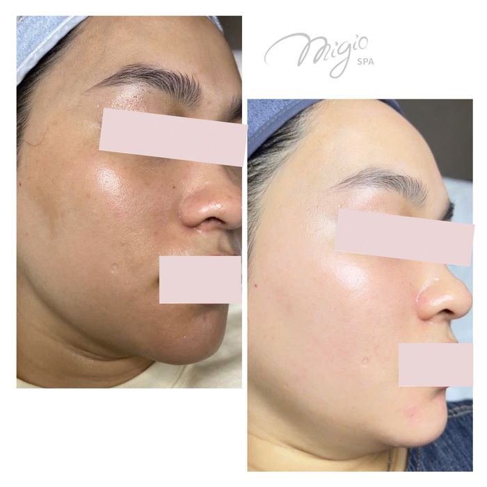 Hình ảnh Migio Spa 2