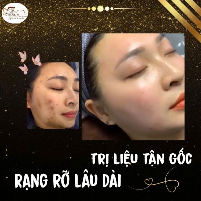 Thẩm Mỹ Hoàng Ân Lào Cai ảnh 2