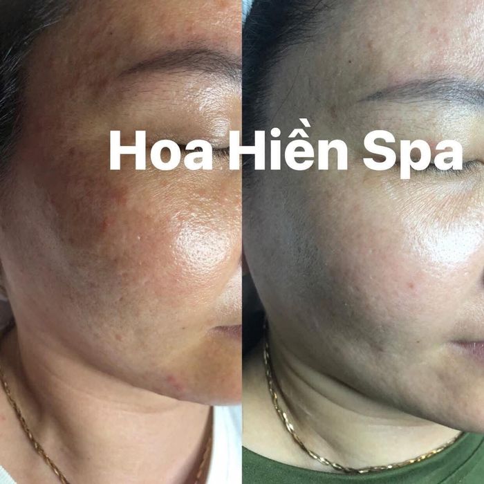 Hình ảnh Hoa Hiền Spa 2
