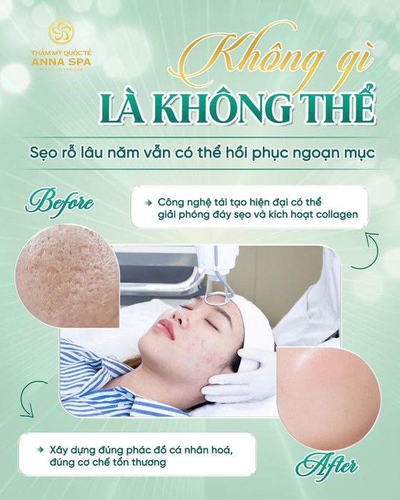 Hình ảnh Thẩm Mỹ Viện Anna Spa 1