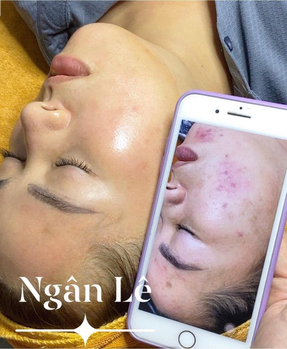 Hình ảnh Ngân Lê Spa 1
