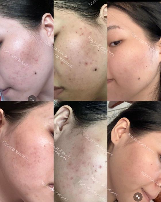 Ảnh Ngọc Ngân Beauty 2