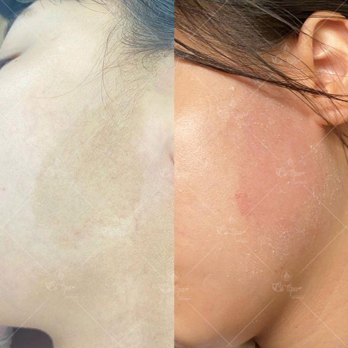 Cỏ Spa hình ảnh 2