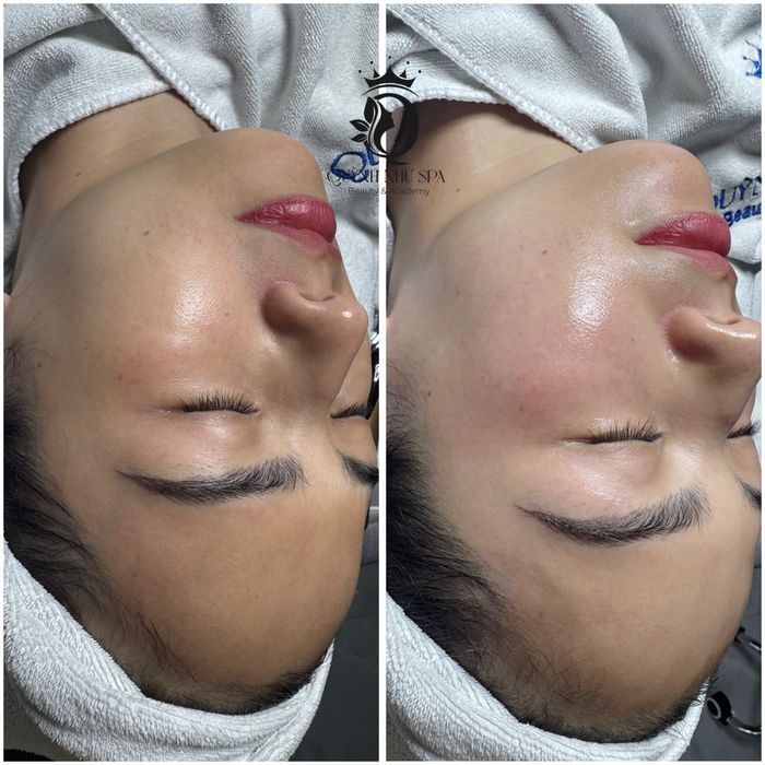 QUỲNH NHƯ Beauty Spa hình ảnh 2