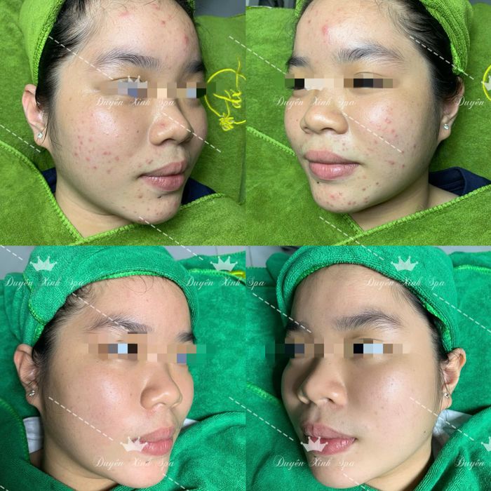 Hình ảnh Duyên Xinh Spa 1