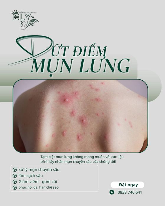 Êly Spa - Beauty Huế ảnh 2