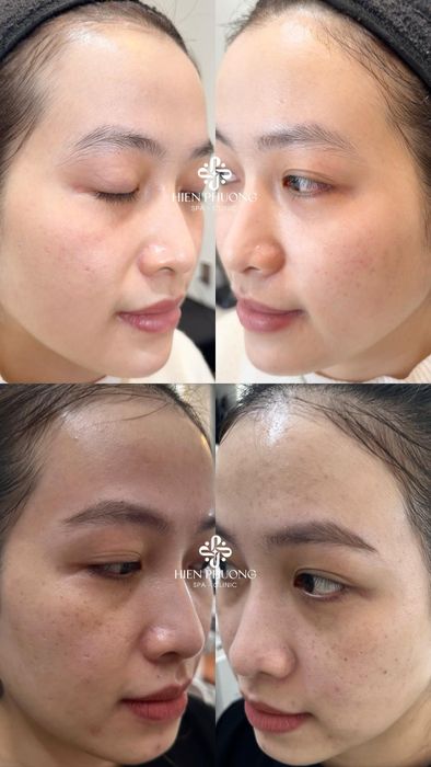 Hiền Phương Spa hình ảnh 2