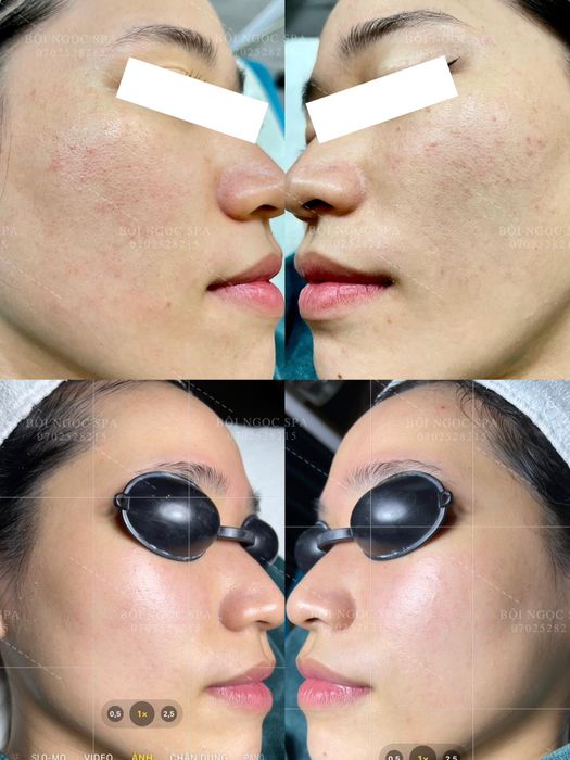 Bội Ngọc Spa hình ảnh 1