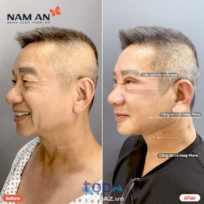 Bệnh viện Thẩm Mỹ Nam An – P. Vườn Lài