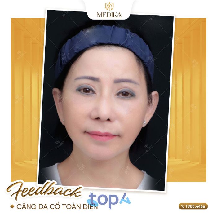 Bệnh viện Thẩm mỹ MEDIKA – P. Hòa Hưng