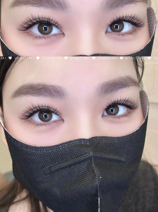 Vi Nối Mi - Hình ảnh 1