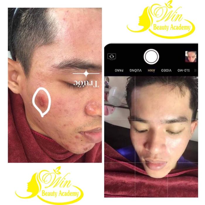 Ảnh 2 của Viện thẩm mỹ quốc tế WIN