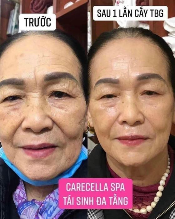 Hình ảnh 1 của Kim Ngân Spa