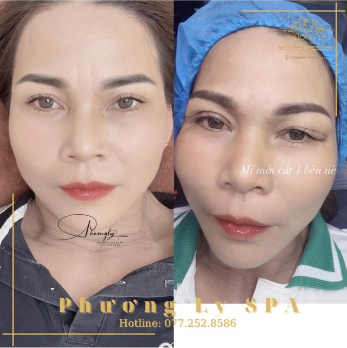 Hình ảnh 2 của Phương Ly Beauty - Spa