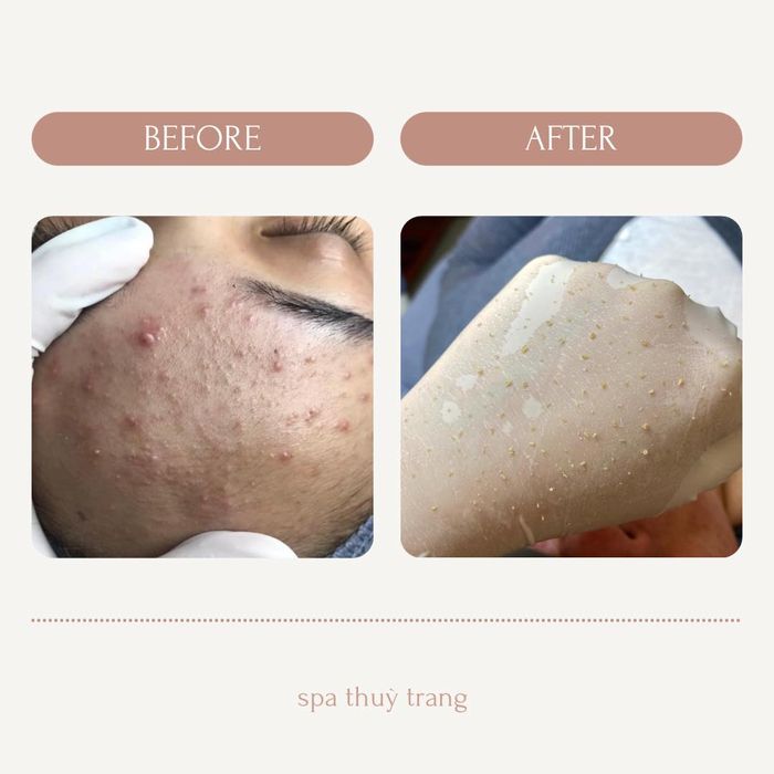Trang Beauty Center hình ảnh 1