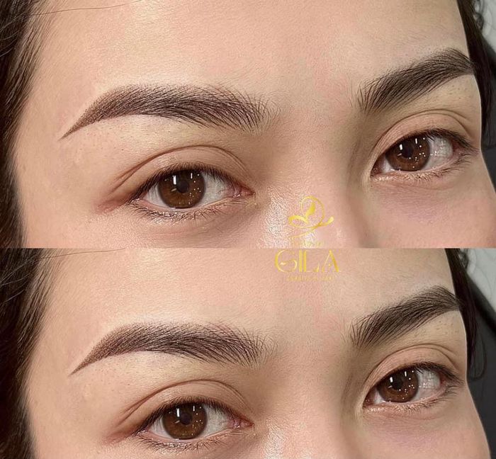 Hình ảnh 1 của Thẩm Mỹ GiLa - Beauty & Spa