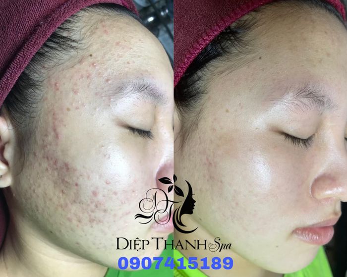 Ảnh 1 Diệp Thanh Spa